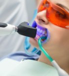 הלבנת שיניים עם מי חמצן - תמונת המחשה